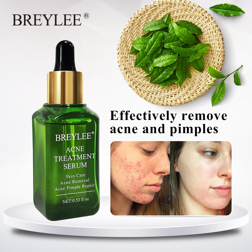 เซรั่มรักษาสิว BREYLEE | Acne Treatment Serum