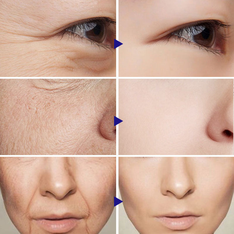 เซรั่มวิตามินซี | Vitamin C Serum