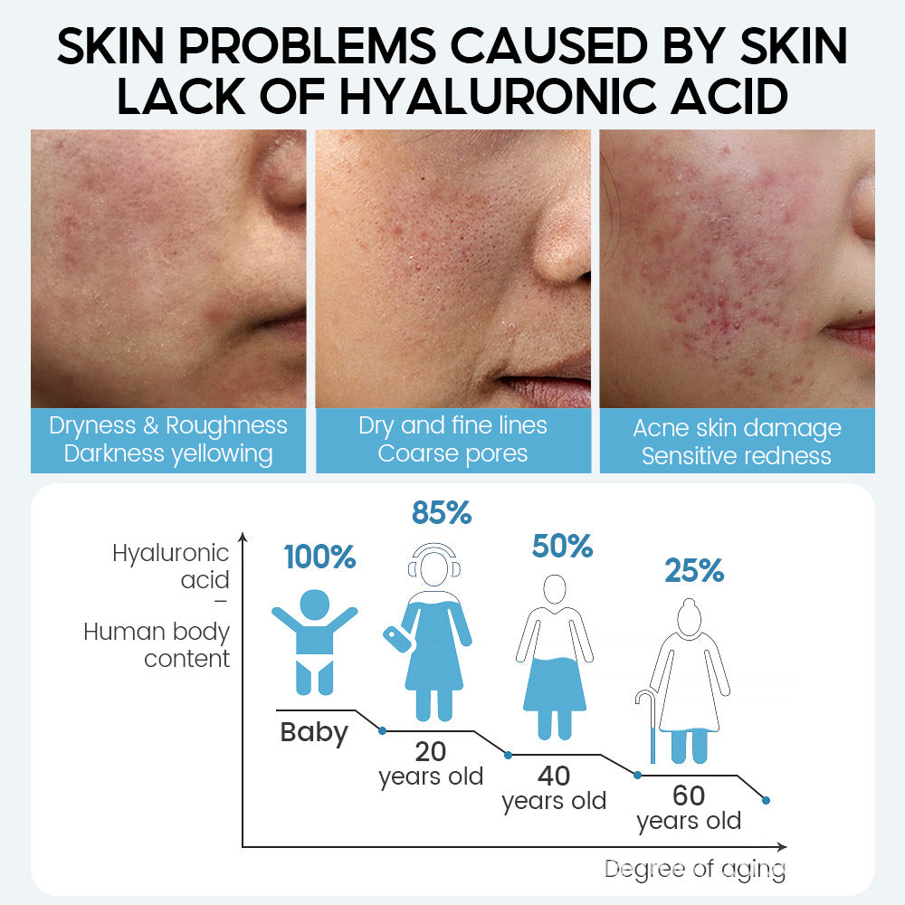 เซรั่มไฮยาลูรอนิก | Hyaluronic Acid Serum